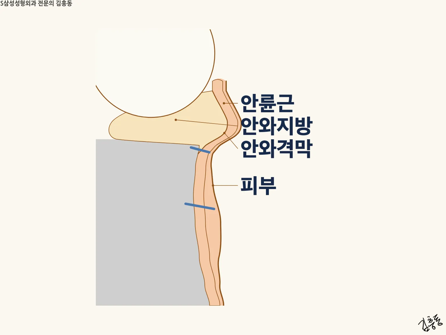 안륜근 · 안와지방 · 안와격막 · 피부 이름표가 붙은 아래눈꺼풀 단면 그림