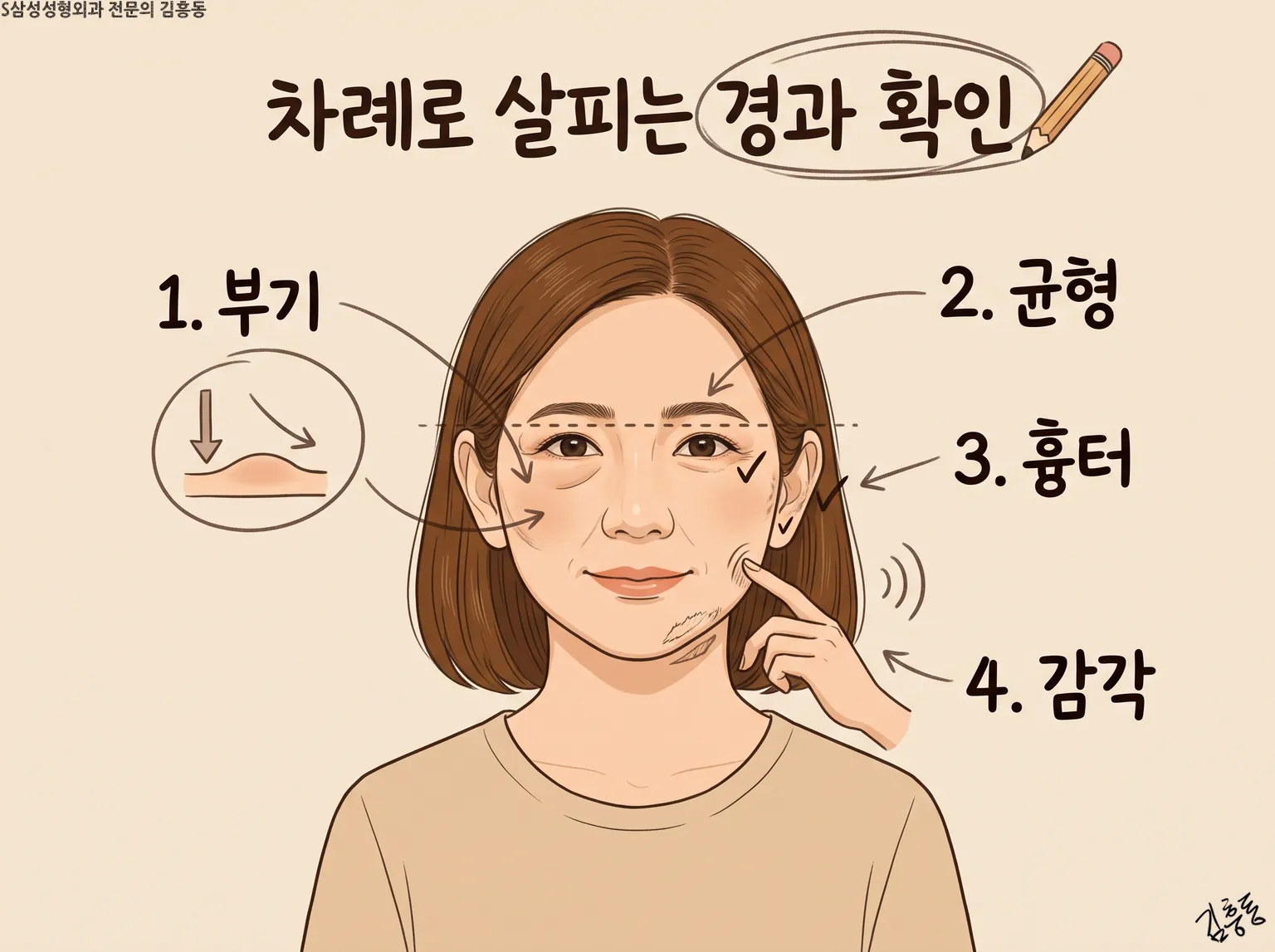 「차례로 살피는 경과 확인」이라는 제목이 적힌, 부기 · 균형 · 흉터 · 감각을 번호로 짚은 얼굴 그림