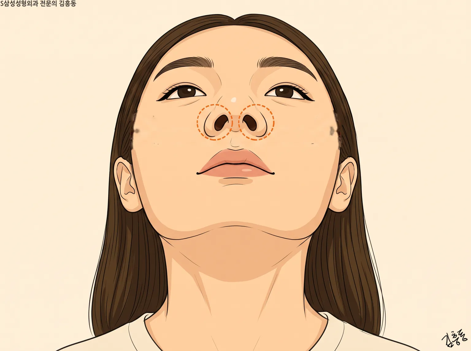 아래에서 올려다본 여성 얼굴에 양쪽 콧구멍을 주황 점선 동그라미로 표시한 그림