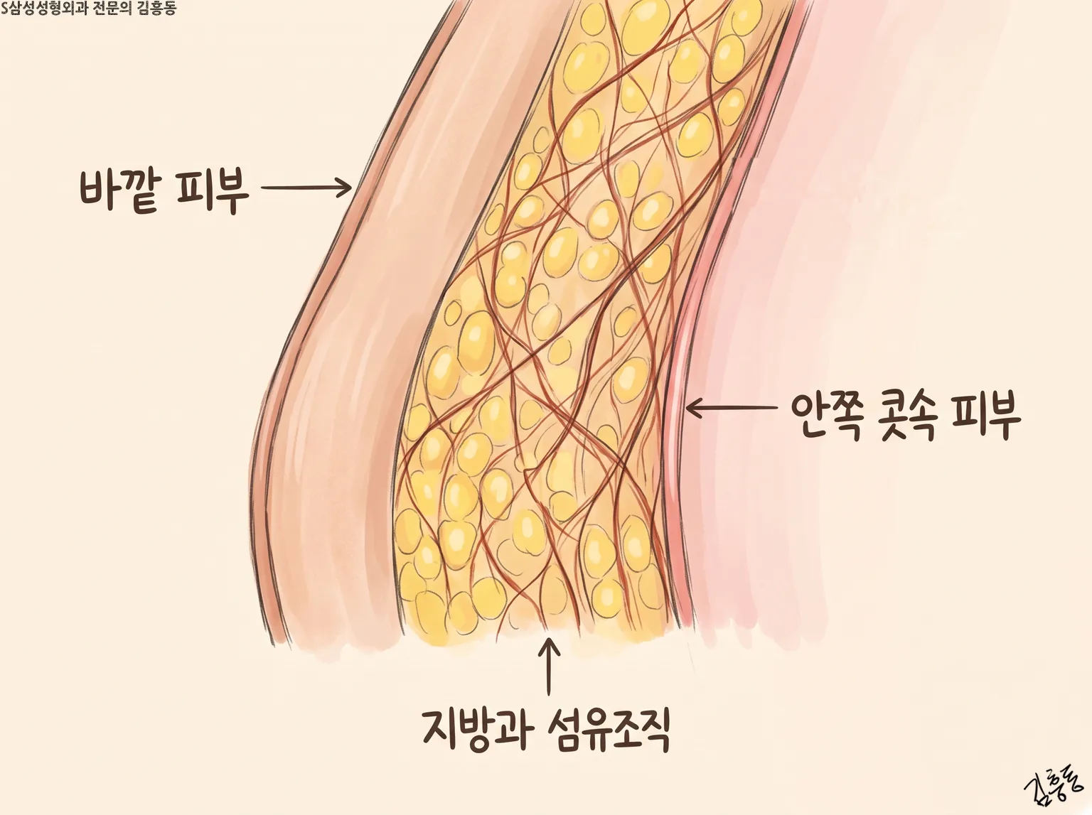 「바깥 피부」 · 「지방과 섬유조직」 · 「안쪽 콧속 피부」 이름표가 붙은 콧날개 벽 단면 그림