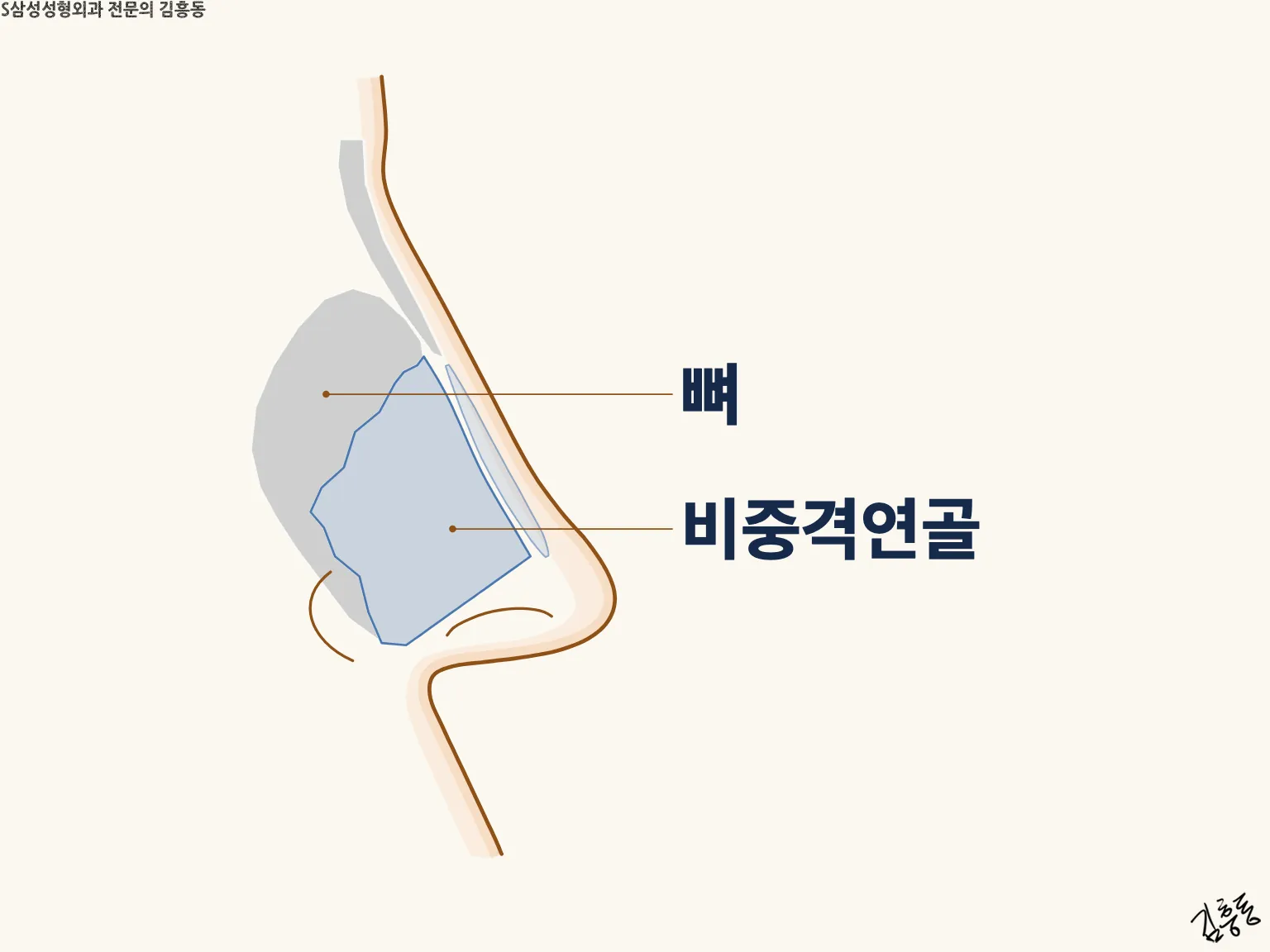 「뼈」 · 「비중격연골」 이름표가 붙은 코 옆 단면 그림