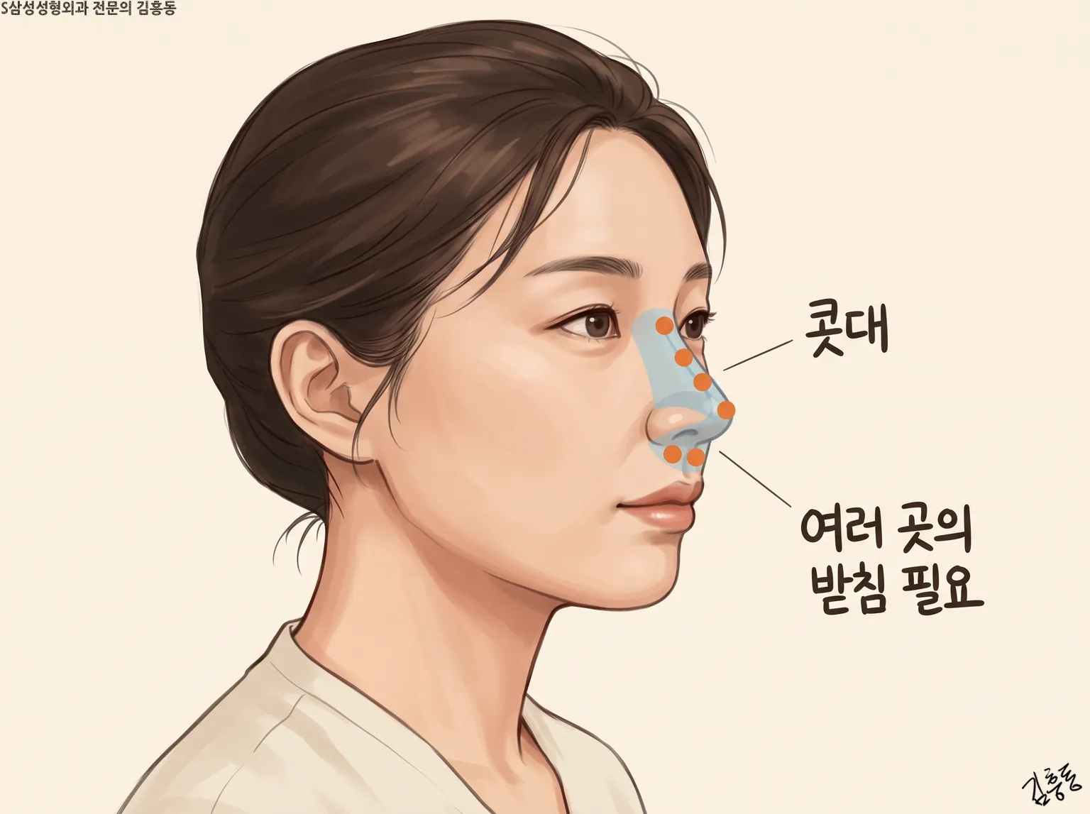 콧대에서 코끝까지 주황 점 여러 개를 찍고 「콧대」 · 「여러 곳의 받침 필요」라고 적은 여성 옆얼굴 그림