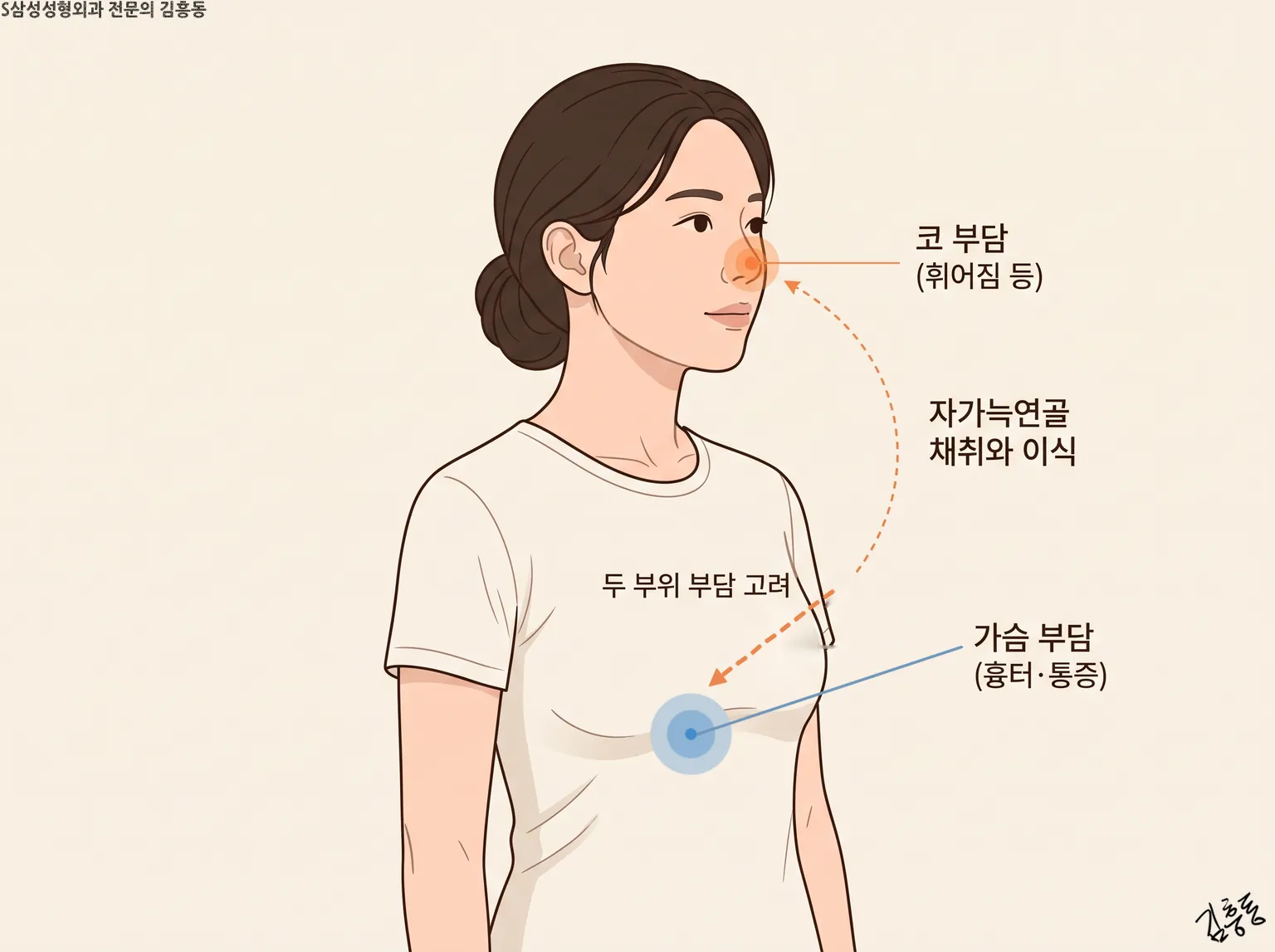 「코 부담(휘어짐 등)」 · 「가슴 부담(흉터·통증)」을 점선 화살표로 이은 여성 상반신 그림