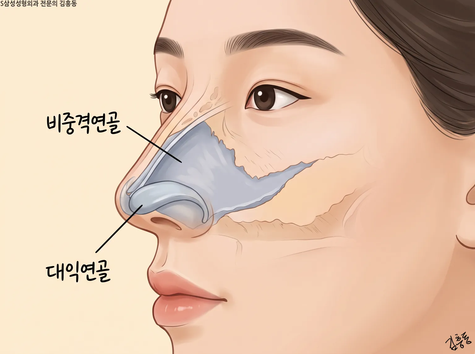 비중격연골과 대익연골 이름표가 붙은, 여성 옆얼굴 속 코 연골 구조를 비춰 그린 그림