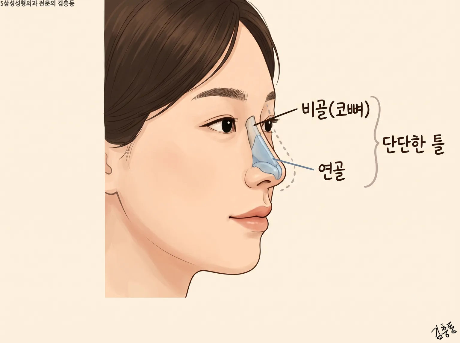 비골(코뼈)과 연골을 묶어 「단단한 틀」이라 적은, 여성 옆얼굴의 코 구조 그림