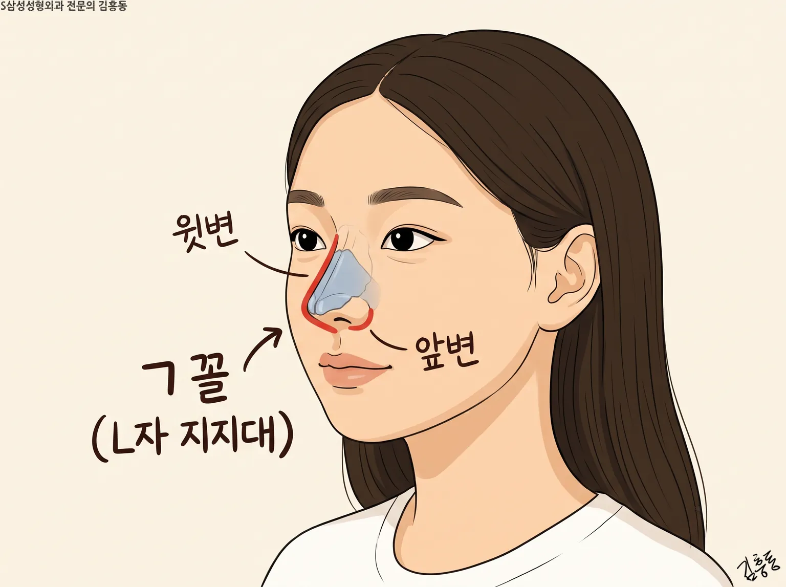 윗변 · 앞변을 빨간 선으로 잇고 「ㄱ꼴(L자 지지대)」라 적은 여성 얼굴 그림
