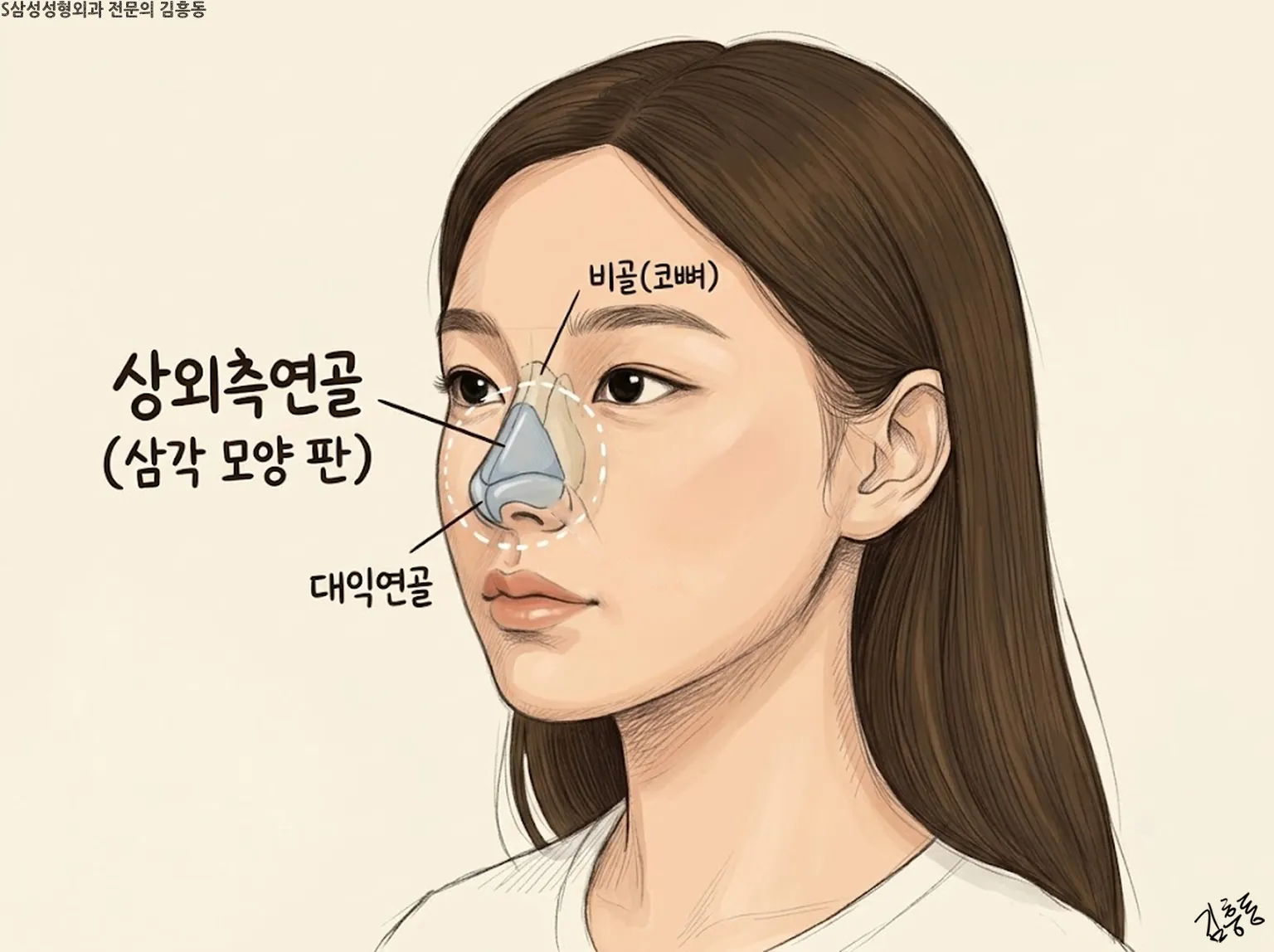 상외측연골(삼각 모양 판) · 비골(코뼈) · 대익연골 이름표가 붙은 여성 얼굴 그림