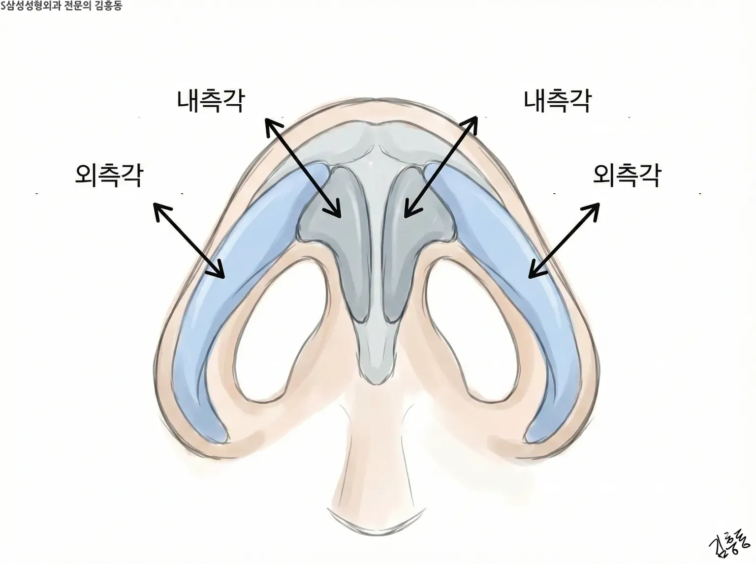 내측각과 외측각 이름표와 화살표로 대익연골의 굽은 띠를 아래에서 본 그림