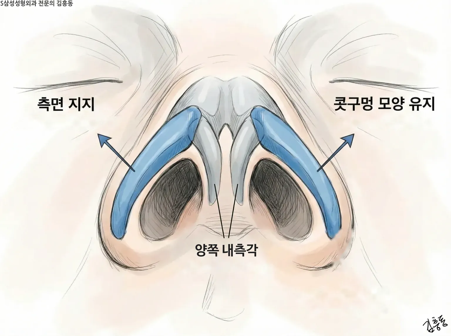 측면 지지 · 콧구멍 모양 유지 · 양쪽 내측각 이름표로 코끝 연골을 아래에서 본 그림