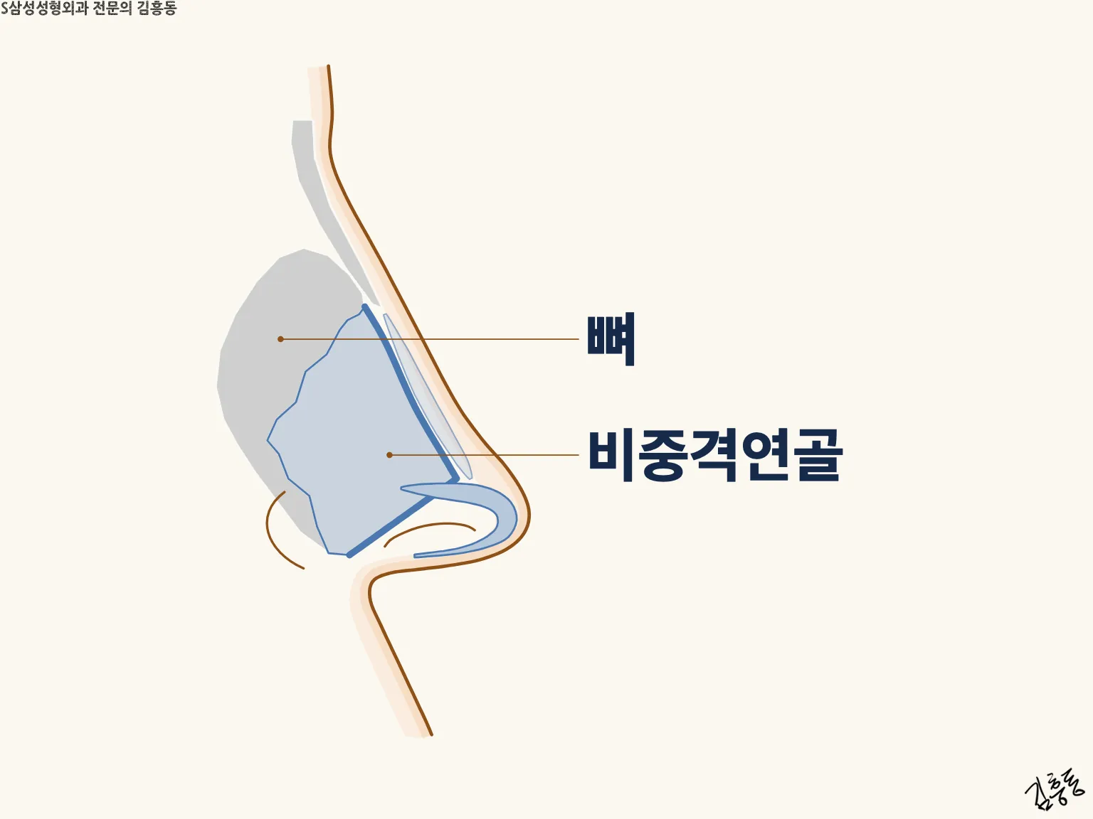 뼈와 비중격연골 이름표가 붙은, 코 옆선 안쪽 가운데 벽의 앞뒤 자리를 그린 그림